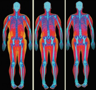 Hologic Body Composition_Progress