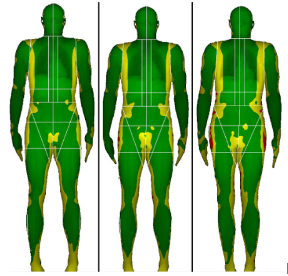 Dexa (DXA) Scans, Body Fat Testing