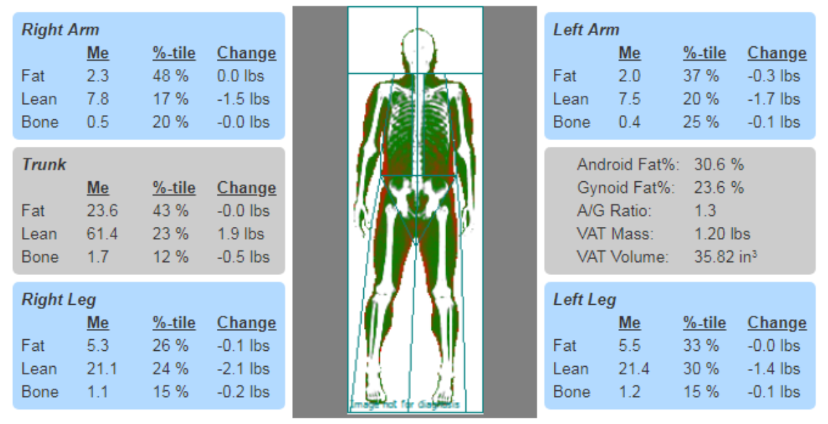 DXA body composition comparisons using percentiles