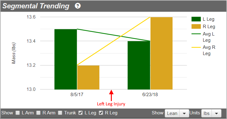 DXA lean mass change in legs due to injury and determing safe return-to-play