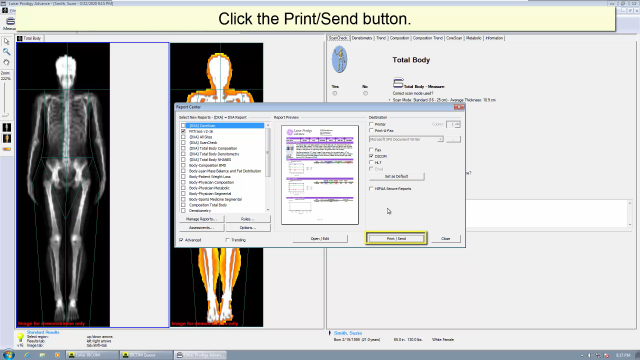 Transfer DXA body composition scan GE